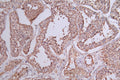 IHC image of CSB-RA644510A0HU diluted at 1:50 and staining in paraffin-embedded human testis tissue performed on a Leica BondTM system. After dewaxing and hydration, antigen retrieval was mediated by high pressure in a citrate buffer (pH 6.0) . Section was blocked with 10% normal goat serum 30min at RT. Then primary antibody (1% BSA) was incubated at 4°C overnight. The primary is detected by a Goat anti-rabbit polymer IgG labeled by HRP and visualized using 0.74% DAB.