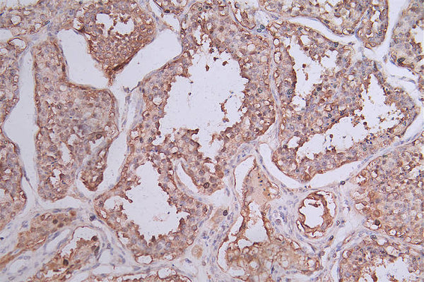 IHC image of CSB-RA644510A0HU diluted at 1:50 and staining in paraffin-embedded human testis tissue performed on a Leica BondTM system. After dewaxing and hydration, antigen retrieval was mediated by high pressure in a citrate buffer (pH 6.0) . Section was blocked with 10% normal goat serum 30min at RT. Then primary antibody (1% BSA) was incubated at 4°C overnight. The primary is detected by a Goat anti-rabbit polymer IgG labeled by HRP and visualized using 0.74% DAB.