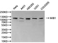Western Blot, 
Positive WB detected in: Hela whole cell lysate(30µg), A431 whole cell lysate(30µg), HEK293 whole cell lysate(30µg), U251 whole cell lysate(30µg), COLO205 whole cell lysate(30µg)
All lanes: MIB1 antibody at 1:1000
Secondary
Goat polyclonal to rabbit IgG at 1/40000 dilution
Predicted band size: 110 kDa
Observed band size: 110 kDa
Exposure time：120s
