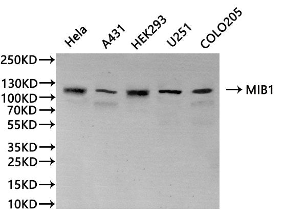 Western Blot, 
Positive WB detected in: Hela whole cell lysate(30µg), A431 whole cell lysate(30µg), HEK293 whole cell lysate(30µg), U251 whole cell lysate(30µg), COLO205 whole cell lysate(30µg)
All lanes: MIB1 antibody at 1:1000
Secondary
Goat polyclonal to rabbit IgG at 1/40000 dilution
Predicted band size: 110 kDa
Observed band size: 110 kDa
Exposure time：120s