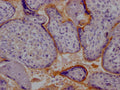 IHC image of CSB-RA669019A0HU diluted at 1:100 and staining in paraffin-embedded human placenta tissue performed on a Leica BondTM system. After dewaxing and hydration, antigen retrieval was mediated by high pressure in a citrate buffer (pH 6.0) . Section was blocked with 10% normal goat serum 30min at RT. Then primary antibody (1% BSA) was incubated at 4℃ overnight. The primary is detected by a Goat anti-rabbit IgG polymer labeled by HRP and visualized using 0.05% DAB.
