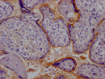 IHC image of CSB-RA669019A0HU diluted at 1:100 and staining in paraffin-embedded human placenta tissue performed on a Leica BondTM system. After dewaxing and hydration, antigen retrieval was mediated by high pressure in a citrate buffer (pH 6.0) . Section was blocked with 10% normal goat serum 30min at RT. Then primary antibody (1% BSA) was incubated at 4℃ overnight. The primary is detected by a Goat anti-rabbit IgG polymer labeled by HRP and visualized using 0.05% DAB.