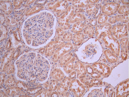 IHC image of CSB-RA67599MA1HU diluted at 1:50 and staining in paraffin-embedded human kidney tissue performed on a Leica BondTM system. After dewaxing and hydration, antigen retrieval was mediated by high pressure in a citrate buffer (pH 6.0). Section was blocked with 10% normal goat serum 30min at RT. Then primary antibody (1% BSA) was incubated at 4°C overnight. The primary is detected by a Anti-Human lgG, Fcy Fragment Specific labeled by HRP and visualized using 0.05% DAB.