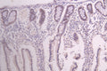 IHC image of CSB-RA679703MA1HU diluted at 1：100 and staining in paraffin-embedded human small intestine tissue performed on a Leica BondTM system. After dewaxing and hydration, antigen retrieval was mediated by high pressure in a citrate buffer (pH 6.0) . Section was blocked with 10% normal goat serum 30min at RT. Then primary antibody (1% BSA) was incubated at 4°C overnight. The primary is detected by a Goat anti-human polymer IgG labeled by HRP and visualized using 0.05% DAB.