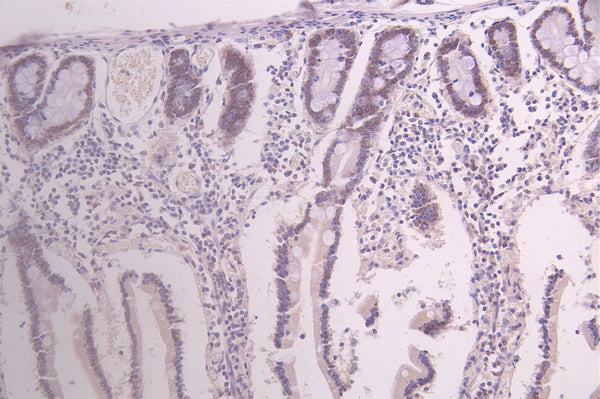 IHC image of CSB-RA679703MA1HU diluted at 1：100 and staining in paraffin-embedded human small intestine tissue performed on a Leica BondTM system. After dewaxing and hydration, antigen retrieval was mediated by high pressure in a citrate buffer (pH 6.0) . Section was blocked with 10% normal goat serum 30min at RT. Then primary antibody (1% BSA) was incubated at 4°C overnight. The primary is detected by a Goat anti-human polymer IgG labeled by HRP and visualized using 0.05% DAB.