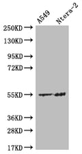 Western Blot
Positive WB detected in: A549 whole cell lysate, Ntera-2 whole cell lysate
All lanes: HMGCS2 antibody at 1:500
Secondary
Goat polyclonal to rabbit IgG at 1/50000 dilution
Predicted band size: 57, 53, 51 kDa
Observed band size: 55 kDa