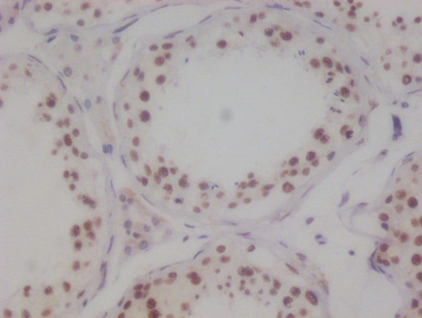 IHC image of CSB-RA694283A0HU diluted at 1:100 and staining in paraffin-embedded human testis tissue performed on a Leica BondTM system. After dewaxing and hydration, antigen retrieval was mediated by high pressure in a citrate buffer (pH 6.0) . Section was blocked with 10% normal goat serum 30min at RT. Then primary antibody (1% BSA) was incubated at 4°C overnight. The primary is detected by a Goat anti-rabbit polymer IgG labeled by HRP and visualized using 0.05% DAB.