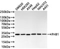 Western Blot
Positive WB detected in: SW620 whole cell lysate(30µg) , HEK293 whole cell lysate(30µg) , A549 whole cell lysate(30µg) , HepG2 whole cell lysate(30µg) , NIH/3T3 whole cell lysate(30µg) , A-431 whole cell lysate(30µg) 
All lanes: PHB1 antibody at 1:1000
Secondary
Goat polyclonal to rabbit IgG at 1/50000 dilution
Predicted band size: 30 kDa
Observed band size: 30 kDa
Exposure time: 1min