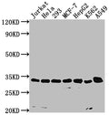 Positive WB detected in: JK whole cell lysate(20µg) , K562 whole cell lysate(20µg) , SY5Y whole cell lysate(20µg) , HepG2 whole cell lysate(20µg) , COLO205 whole cell lysate(20µg)