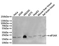 Western Blot
Positive WB detected in: Hela whole cell lysate(30µg), A549 whole cell lysate(30µg), HEK293 whole cell lysate(30µg), A375 whole cell lysate(30µg), HepG2 whole cell lysate(30µg), Mouse liver tissue lysate(30µg), Rat brain tissue lysate(30µg)
All lanes: eIF1AX antibody at 1:1000
Secondary
Goat polyclonal to rabbit IgG at 1/40000 dilution
Predicted band size: 16 kDa
Observed band size: 18 kDa
Exposure time：1min