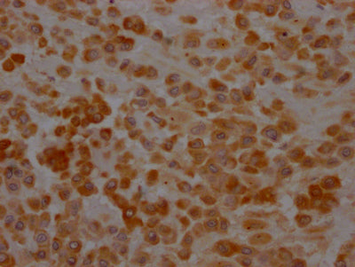 IHC image of CSB-RA699016A0HU diluted at 1:100 and staining in paraffin-embedded human placenta tissue performed on a Leica BondTM system. After dewaxing and hydration, antigen retrieval was mediated by high pressure in a citrate buffer (pH 6.0) . Section was blocked with 10% normal goat serum 30min at RT. Then primary antibody (1% BSA) was incubated at 4℃ overnight. The primary is detected by a Goat anti-rabbit IgG polymer labeled by HRP and visualized using 0.05% DAB.