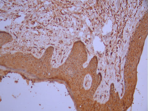 IHC image of CSB-RA699080A0HU diluted at 1:100 and staining in paraffin-embedded human skin tissue performed on a Leica BondTM system. After dewaxing and hydration, antigen retrieval was mediated by high pressure in a citrate buffer (pH 6.0). Section was blocked with 10% normal goat serum 30min at RT. Then primary antibody (1% BSA) was incubated at 4°C overnight. The primary is detected by a Goat anti-rabbit polymer IgG labeled by HRP and visualized using 0.05% DAB.