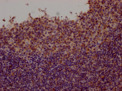 IHC image of CSB-RA699767A0HU diluted at 1:100 and staining in paraffin-embedded human tonsil tissue performed on a Leica BondTM system. After dewaxing and hydration, antigen retrieval was mediated by high pressure in a citrate buffer (pH 6.0) . Section was blocked with 10% normal goat serum 30min at RT. Then primary antibody (1% BSA) was incubated at 4℃ overnight. The primary is detected by a Goat anti-rabbit IgG polymer labeled by HRP and visualized using 0.05% DAB.