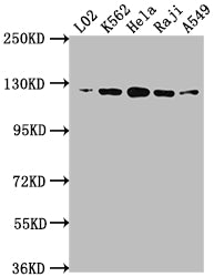 Western Blot
Positive WB detected in: L02 whole cell lysate, K562 whole cell lysate, Hela whole cell lysate, Raji whole cell lysate, A549 whole cell lysate
All lanes: ACLY antibody at 1:1500
Secondary
Goat polyclonal to rabbit IgG at 1/50000 dilution
Predicted band size: 121, 120, 92 kDa
Observed band size: 120 kDa