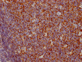 IHC image of CSB-RA714310A0HU diluted at 1:100 and staining in paraffin-embedded human tonsil tissue performed on a Leica BondTM system. After dewaxing and hydration, antigen retrieval was mediated by high pressure in a citrate buffer (pH 6.0) . Section was blocked with 10% normal goat serum 30min at RT. Then primary antibody (1% BSA) was incubated at 4℃ overnight. The primary is detected by a Goat anti-rabbit IgG polymer labeled by HRP and visualized using 0.05% DAB.