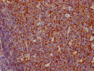 IHC image of CSB-RA714310A0HU diluted at 1:100 and staining in paraffin-embedded human tonsil tissue performed on a Leica BondTM system. After dewaxing and hydration, antigen retrieval was mediated by high pressure in a citrate buffer (pH 6.0) . Section was blocked with 10% normal goat serum 30min at RT. Then primary antibody (1% BSA) was incubated at 4℃ overnight. The primary is detected by a Goat anti-rabbit IgG polymer labeled by HRP and visualized using 0.05% DAB.