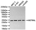 Western Blot
Positive WB detected in: MCF-7 whole cell lysate(30µg) , A-431 whole cell lysate(30µg) , HEK293 whole cell lysate(30µg) , colo205 whole cell lysate(30µg) 
All lanes: METRNL antibody at 1:1000
Secondary
Goat polyclonal to human IgG at 1/40000 dilution
Predicted band size: 34 kDa
Observed band size: 34 kDa
Exposure time: 3min