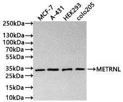 Western Blot
Positive WB detected in: MCF-7 whole cell lysate(30µg) , A-431 whole cell lysate(30µg) , HEK293 whole cell lysate(30µg) , colo205 whole cell lysate(30µg) 
All lanes: METRNL antibody at 1:1000
Secondary
Goat polyclonal to human IgG at 1/40000 dilution
Predicted band size: 34 kDa
Observed band size: 34 kDa
Exposure time: 3min