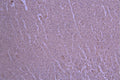 IHC image of CSB-RA733162MA1HU diluted at 1：50 and staining in paraffin-embedded human kidney tissue performed on a Leica BondTM system. After dewaxing and hydration, antigen retrieval was mediated by high pressure in a citrate buffer (pH 6.0) . Section was blocked with 10% normal goat serum 30min at RT. Then primary antibody (1% BSA) was incubated at 4°C overnight. The primary is detected by a Anti-Human lgG, Fcy Fragment Specific labeled by HRP and visualized using 0.05% DAB.