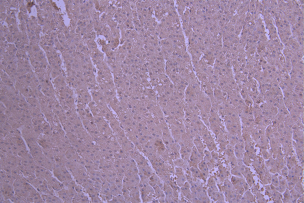 IHC image of CSB-RA733162MA1HU diluted at 1：50 and staining in paraffin-embedded human kidney tissue performed on a Leica BondTM system. After dewaxing and hydration, antigen retrieval was mediated by high pressure in a citrate buffer (pH 6.0) . Section was blocked with 10% normal goat serum 30min at RT. Then primary antibody (1% BSA) was incubated at 4°C overnight. The primary is detected by a Anti-Human lgG, Fcy Fragment Specific labeled by HRP and visualized using 0.05% DAB.