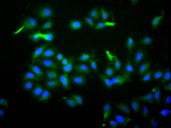 Immunofluorescence staining of Hela cell with CSB-RA751251MA1HU at 1:30, counter-stained with DAPI. The cells were fixed in 4% formaldehyde and blocked in 10% normal Goat Serum. The cells were then incubated with the antibody overnight at 4C. The secondary antibody was FITC-conjugated AffiniPure Goat Anti-Human IgG(H+L) .