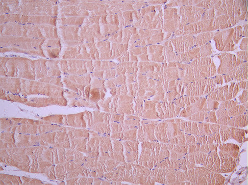 IHC image of CSB-RA761624MA1HU diluted at 1:50 and staining in paraffin-embedded mouse skeletal muscle tissue performed on a Leica BondTM system. After dewaxing and hydration, antigen retrieval was mediated by high pressure in a citrate buffer (pH 6.0). Section was blocked with 10% normal goat serum 30min at RT. Then primary antibody (1% BSA) was incubated at 4°C overnight. The primary is detected by a Anti-Human lgG, Fcy Fragment Specific labeled by HRP and visualized using 0.05% DAB.