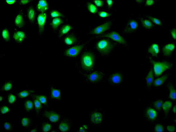 Immunofluorescence staining of Hela cell with CSB-RA768658A0HU at 1:50, counter-stained with DAPI. The cells were fixed in 4% formaldehyde, permeabilized using 0.2% Triton X-100 and blocked in 10% normal Goat Serum. The cells were then incubated with the antibody overnight at 4°C. The secondary antibody was Alexa Fluor 488-congugated AffiniPure Goat Anti-Rabbit IgG(H+L) .
