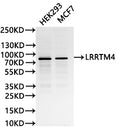 Western Blot
Positive WB detected in: HEK293 whole cell lysate(30µg),MCF7 whole cell lysate(30µg)
All lanes: LRRTM4 antibody at 1:1000
Secondary
Goat polyclonal to human IgG at 1/40000 dilution
Predicted band size: 67 kDa
Observed band size: 80 kDa
Exposure time: 120s