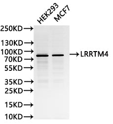 Western Blot
Positive WB detected in: HEK293 whole cell lysate(30µg),MCF7 whole cell lysate(30µg)
All lanes: LRRTM4 antibody at 1:1000
Secondary
Goat polyclonal to human IgG at 1/40000 dilution
Predicted band size: 67 kDa
Observed band size: 80 kDa
Exposure time: 120s