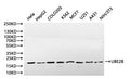 Western Blot, 
Positive WB detected in:Hela whole cell lysate(30µg), COLO205 whole cell lysate(30µg), HepG2 whole cell lysate(30µg), K562 whole cell lysate(30µg), MCF7 whole cell lysate(30µg), U251 whole cell lysate(30µg), A431 whole cell lysate(30µg), NIH/3T3 whole cell lysate(30µg)
All lanes: UBE2B antibody at 1:1000
Secondary
Goat polyclonal to rabbit IgG at 1/40000 dilution
Predicted band size: 17 kDa
Observed band size: 17 kDa
Exposure time：120s
