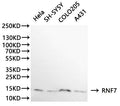 Western Blot
Positive WB detected in: Hela whole cell lysate(30µg), HepG2 whole cell lysate(30µg), COLO-205 whole cell lysate(30µg), A431 whole cell lysate(30µg)
All lanes: RNF7 antibody at 1:1000
Secondary
Goat polyclonal to rabbit IgG at 1/40000 dilution
Predicted band size: 13 kDa
Observed band size: 13 kDa
Exposure time：2min