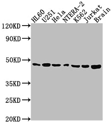 Western Blot
Positive WB detected in: HL60 whole cell lysate, U251 whole cell lysate, Hela whole cell lysate, NTERA-2 whole cell lysate, K562 whole cell lysate, Jurkat whole cell lysate, Rat brain tissue
All lanes: F3 antibody at 1:1500
Secondary
Goat polyclonal to rabbit IgG at 1/50000 dilution
Predicted band size: 34, 28 kDa
Observed band size: 46 kDa