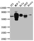 Western Blot
Positive WB detected in: NIH/3T3 whole cell lysate, MCF-7 whole cell lysate, Hela whole cell lysate, 293T whole cell lysate, Mouse Brain whole cell lysate
All lanes: S6K1 antibody at 1:1000
Secondary
Goat polyclonal to rabbit IgG at 1/50000 dilution
Predicted band size: 60, 57, 53, 57, 52 kDa
Observed band size: 70 kDa