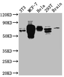 Western Blot
Positive WB detected in: NIH/3T3 whole cell lysate, MCF-7 whole cell lysate, Hela whole cell lysate, 293T whole cell lysate, Mouse Brain whole cell lysate
All lanes: S6K1 antibody at 1:1000
Secondary
Goat polyclonal to rabbit IgG at 1/50000 dilution
Predicted band size: 60, 57, 53, 57, 52 kDa
Observed band size: 70 kDa