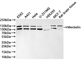 Western Blot
Positive WB detected in: K562 whole cell lysate(30µg) , A431 whole cell lysate(30µg) , Hela whole cell lysate(30µg) , U-251MG whole cell lysate(30µg) , HEK293 whole cell lysate(30µg) , MCF-7 whole cell lysate(30µg) , Rat brain tissue lysate(30µg) 
All lanes: Meckelin polymerase beta antibody at 1:1000
Secondary
Goat polyclonal to rabbit IgG at 1/40000 dilution
Predicted band size: 112 kDa
Observed band size: 112, 122 kDa
Exposure time：1min