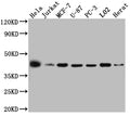 Western Blot
Positive WB detected in: Hela whole cell lysate, Jurkat whole cell lysate, MCF-7 whole cell lysate, U-87 whole cell lysate, PC-3 whole cell lysate, L02 whole cell lysate, Rat Heart whole cell lysate
All lanes: p38 MAPK antibody at 1:1000
Secondary
Goat polyclonal to rabbit IgG at 1/50000 dilution
Predicted band size: 42, 42, 35, 36, 30 kDa
Observed band size: 42 kDa