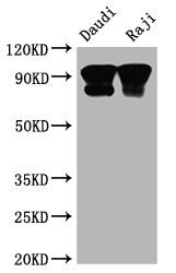 Western Blot
Positive WB detected in: Daudi whole cell lysate, Raji whole cell lysate
All lanes: CD19 antibody at 1:2000
Secondary
Goat polyclonal to rabbit IgG at 1/50000 dilution
Predicted band size: 62 kDa
Observed band size: 95 kDa