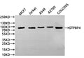 Western Blot
Positive WB detected in: MCF7 whole cell lysate(30µg), Jurkat whole cell lysate(30µg), A549 whole cell lysate(30µg), A2780 whole cell lysate(30µg), COLO205 whole cell lysate(30µg)
All lanes:GTPBP4 antibody at 1:1000
Secondary
Goat polyclonal to rabbit IgG at 1/40000 dilution
Predicted band size: 74 kDa
Observed band size: 80 kDa
Exposure time：1min