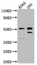 Western Blot
Positive WB detected in: K562 whole cell lysate, 293 whole cell lysate
All lanes: Caspase-2 antibody at 1:1000
Secondary
Goat polyclonal to rabbit IgG at 1/50000 dilution
Predicted band size: 51, 35, 11 kDa
Observed band size: 51 kDa