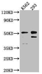 Western Blot
Positive WB detected in: K562 whole cell lysate, 293 whole cell lysate
All lanes: Caspase-2 antibody at 1:1000
Secondary
Goat polyclonal to rabbit IgG at 1/50000 dilution
Predicted band size: 51, 35, 11 kDa
Observed band size: 51 kDa
