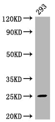 Western Blot
Positive WB detected in: 293 whole cell lysate
All lanes: Mad2L2 antibody at 1:2000
Secondary
Goat polyclonal to rabbit IgG at 1/50000 dilution
Predicted band size: 25 kDa
Observed band size: 25 kDa