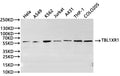 Western Blot
Positive WB detected in: Hela whole cell lysate(30µg), A549 whole cell lysate(30µg), K562 whole cell lysate(30µg), A2780 whole cell lysate(30µg), Jurkat whole cell lysate(30µg), A431 whole cell lysate(30µg), THP-1 whole cell lysate(30µg), COLO205 whole cell lysate(30µg)
All lanes:TBL1XR1 antibody at 1:1000
Secondary
Goat polyclonal to rabbit IgG at 1/40000 dilution
Predicted band size: 56 kDa
Observed band size: 56 kDa
Exposure time：2min