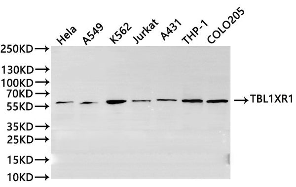 Western Blot
Positive WB detected in: Hela whole cell lysate(30µg), A549 whole cell lysate(30µg), K562 whole cell lysate(30µg), A2780 whole cell lysate(30µg), Jurkat whole cell lysate(30µg), A431 whole cell lysate(30µg), THP-1 whole cell lysate(30µg), COLO205 whole cell lysate(30µg)
All lanes:TBL1XR1 antibody at 1:1000
Secondary
Goat polyclonal to rabbit IgG at 1/40000 dilution
Predicted band size: 56 kDa
Observed band size: 56 kDa
Exposure time：2min