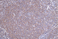 IHC image of CSB-RA783071A0HU diluted at 1:50 and staining in paraffin-embedded human tonsil tissue performed on a Leica BondTM system. After dewaxing and hydration, antigen retrieval was mediated by high pressure in a citrate buffer (pH 6.0) . Section was blocked with 10% normal goat serum 30min at RT. Then primary antibody (1% BSA) was incubated at 4°C overnight. The primary is detected by a Goat anti-rabbit polymer IgG labeled by HRP and visualized using 0.17% DAB.