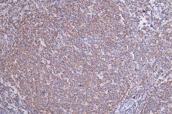 IHC image of CSB-RA783071A0HU diluted at 1:50 and staining in paraffin-embedded human tonsil tissue performed on a Leica BondTM system. After dewaxing and hydration, antigen retrieval was mediated by high pressure in a citrate buffer (pH 6.0) . Section was blocked with 10% normal goat serum 30min at RT. Then primary antibody (1% BSA) was incubated at 4°C overnight. The primary is detected by a Goat anti-rabbit polymer IgG labeled by HRP and visualized using 0.17% DAB.