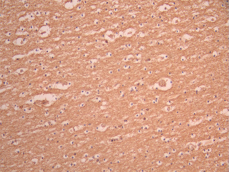 IHC image of CSB-RA783404A0HU diluted at 1:100 and staining in paraffin-embedded human brain tissue performed on a Leica BondTM system. After dewaxing and hydration, antigen retrieval was mediated by high pressure in a citrate buffer (pH 6.0). Section was blocked with 10% normal goat serum 30min at RT. Then primary antibody (1% BSA) was incubated at 4°C overnight. The primary is detected by a Goat anti-rabbit polymer IgG labeled by HRP and visualized using 0.05% DAB.