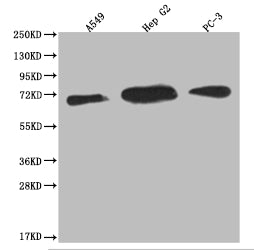 Western Blot
Positive WB detected in: A549 whole cell lysate, HepG2 whole cell lysate, PC3 whole cell lysate
All lanes: USP22 antibody at 1:2000
Secondary
Goat polyclonal to rabbit IgG at 1/50000 dilution
Predicted band size: 60, 59 kDa
Observed band size: 55-72 kDa