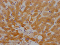 IHC image of CSB-RA784971A0HU diluted at 1:100 and staining in paraffin-embedded human liver tissue performed on a Leica BondTM system. After dewaxing and hydration, antigen retrieval was mediated by high pressure in a citrate buffer (pH 6.0) . Section was blocked with 10% normal goat serum 30min at RT. Then primary antibody (1% BSA) was incubated at 4℃ overnight. The primary is detected by a Goat anti-rabbit IgG polymer labeled by HRP and visualized using 0.05% DAB.