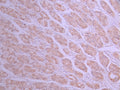 IHC image of CSB-RA785472A0HU diluted at 1:100 and staining in paraffin-embedded human stomach tissue performed on a Leica BondTM system. After dewaxing and hydration, antigen retrieval was mediated by high pressure in a citrate buffer (pH 6.0) . Section was blocked with 10% normal goat serum 30min at RT. Then primary antibody (1% BSA) was incubated at 4°C overnight. The primary is detected by a Goat anti-rabbit polymer IgG labeled by HRP and visualized using 0.05% DAB.