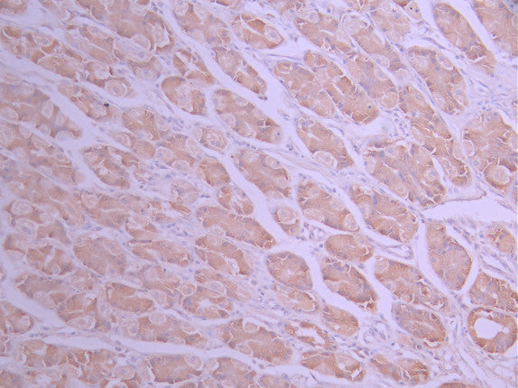 IHC image of CSB-RA785472A0HU diluted at 1:100 and staining in paraffin-embedded human stomach tissue performed on a Leica BondTM system. After dewaxing and hydration, antigen retrieval was mediated by high pressure in a citrate buffer (pH 6.0) . Section was blocked with 10% normal goat serum 30min at RT. Then primary antibody (1% BSA) was incubated at 4°C overnight. The primary is detected by a Goat anti-rabbit polymer IgG labeled by HRP and visualized using 0.05% DAB.